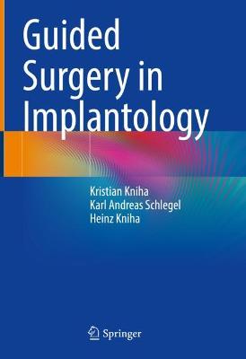 Guided Surgery in Implantology 2021 ed.
