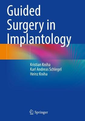 Guided Surgery in Implantology 2021 ed.