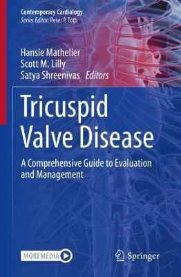 Tricuspid Valve Disease: A Comprehensive Guide to Evaluation and Management 2022 ed.