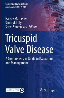 Tricuspid Valve Disease: A Comprehensive Guide to Evaluation and Management 2022 ed.