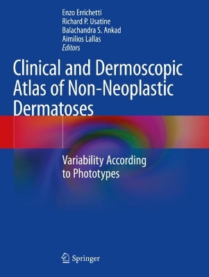 Clinical and Dermoscopic Atlas of Non-Neoplastic Dermatoses: Variability According to Phototypes 2023 ed.