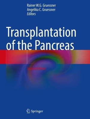 Transplantation of the Pancreas Second Edition 2023