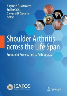 Shoulder Arthritis across the Life Span: From Joint Preservation to Arthroplasty 2023 ed.