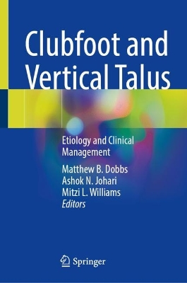 Clubfoot and Vertical Talus: Etiology and Clinical Management