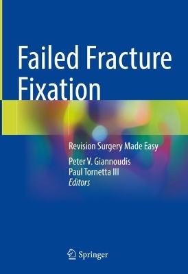 Failed Fracture Fixation: Revision Surgery Made Easy