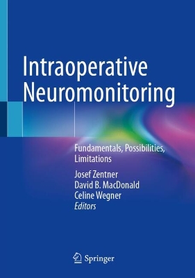 Intraoperative Neuromonitoring: Fundamentals, Possibilities, Limitations 2024 ed.