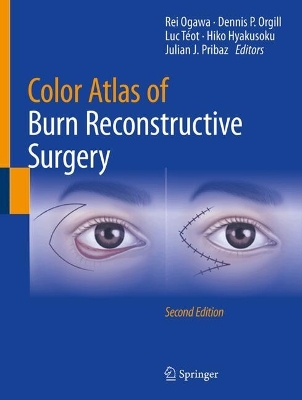 Color Atlas of Burn Reconstructive Surgery Second Edition 2025