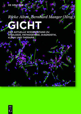 Gicht: Der aktuelle Wissensstand zu Atiologie, Pathogenese, Diagnostik, Klinik und Therapie