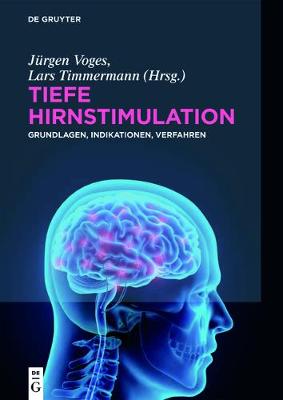 Tiefe Hirnstimulation: Grundlagen, Indikationen, Verfahren
