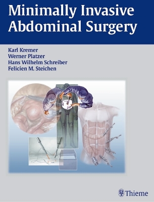 Minimally Invasive Abdominal Surgery: Laparascopic and Thoracic Surgery New edition