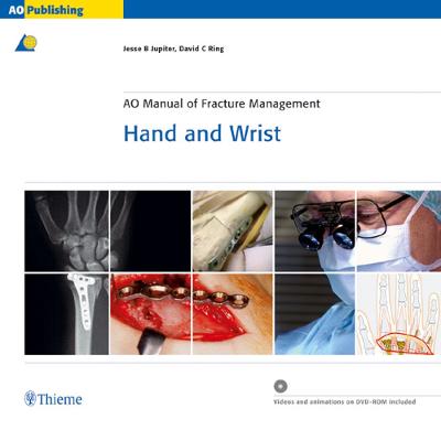 AO Manual of Fracture Management - Hand and Wrist New edition