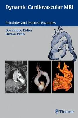 Dynamic Cardiovascular Mri: Principles and Practical Examples