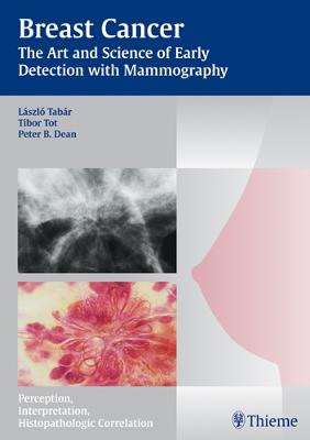 Breast Cancer: The Art and Science of Early Detection with Mammography