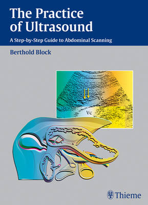Practice of Ultrasound: A Step-by-step Teaching Guide