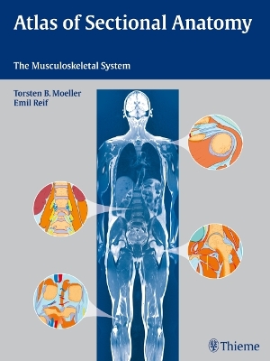 Atlas of Sectional Anatomy: The Musculoskeletal System New edition