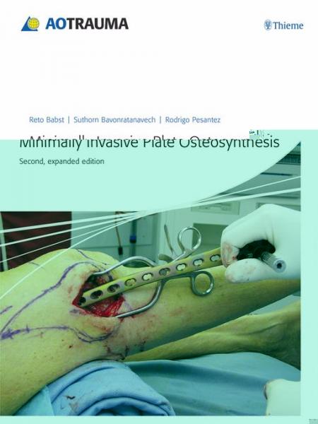 Minimally Invasive Plate Osteosynthesis (MIPO)