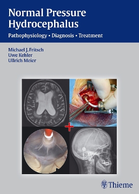 Normal Pressure Hydrocephalus: Pathophysiology - Diagnosis - Treatment