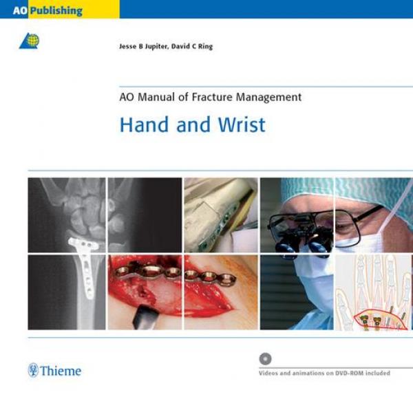AO Manual of Fracture Management - Hand and Wrist