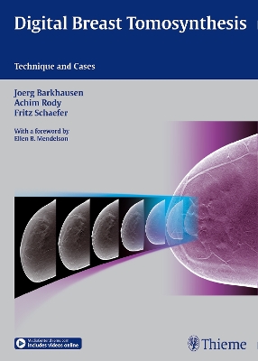 Digital Breast Tomosynthesis: Technique and Cases New edition