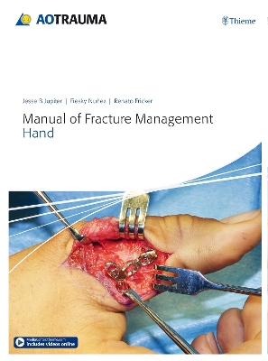 Manual of Fracture Management - Hand New edition