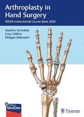 Arthroplasty in Hand Surgery: FESSH Instructional Course Book 2020