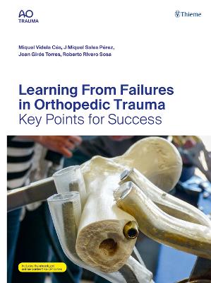 Learning from Failures in Orthopedic Trauma: Key Points for Success New edition