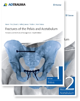 Fractures of the Pelvis and Acetabulum (AO): Principles and Methods of Management