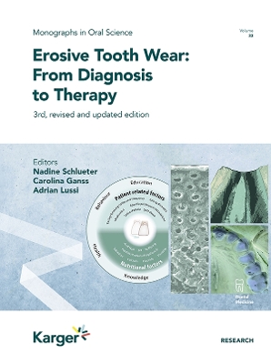 Erosive Tooth Wear: From Diagnosis to Therapy: 3rd, revised and updated edition 3rd, revised and updated edition
