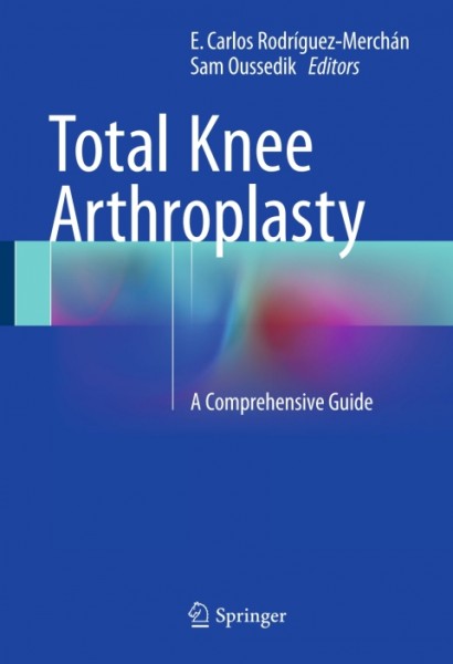 Total Knee Arthroplasty: A Comprehensive Guide