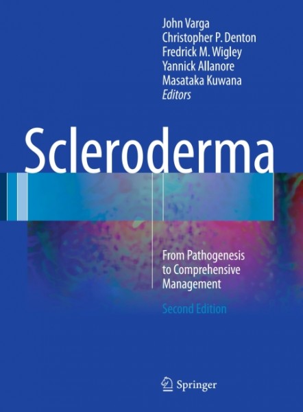 Scleroderma: From Pathogenesis to Comprehensive Management