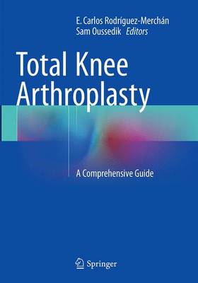 Total Knee Arthroplasty: A Comprehensive Guide Softcover Reprint of the Original 1st 2015 ed.