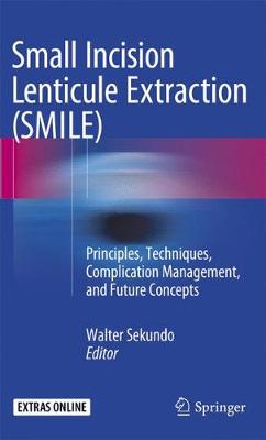 Small Incision Lenticule Extraction (SMILE): Principles, Techniques, Complication Management, and Future Concepts Softcover Reprint of the Original 1st 2015 ed.