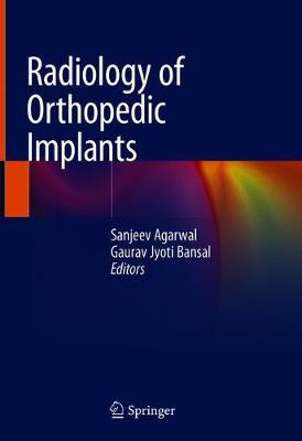 Radiology of Orthopedic Implants