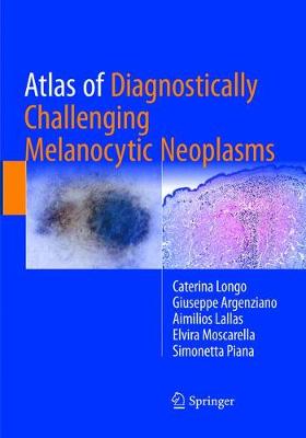 Atlas of Diagnostically Challenging Melanocytic Neoplasms Softcover reprint of the original 1st ed. 2018