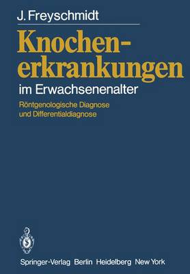 Knochenerkrankungen Im Erwachsenenalter: Rontgenologische Diagnose Und Differentialdiagnose