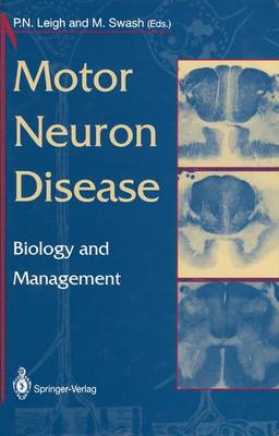Motor Neuron Disease: Biology and Management Edition. ed.