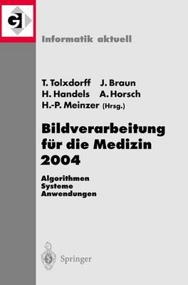 Bildverarbeitung fÃ¼r die Medizin 2004: Algorithmen - Systeme - Anwendungen