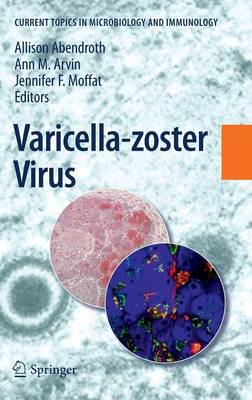 Varicella-zoster Virus 2010 ed.