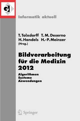 Bildverarbeitung fÃ¼r die Medizin 2012: Algorithmen - Systeme - Anwendungen. Proceedings des Workshops vom 18. bis 20. Marz 2012 in Berlin