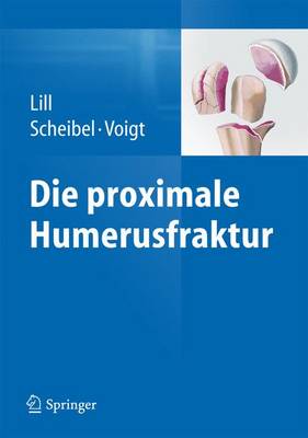 Die proximale Humerusfraktur 2014 ed.