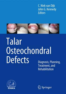 Talar Osteochondral Defects: Diagnosis, Planning, Treatment, and Rehabilitation 2014 ed.