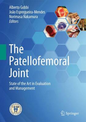 Patellofemoral Joint: State of the Art in Evaluation and Management
