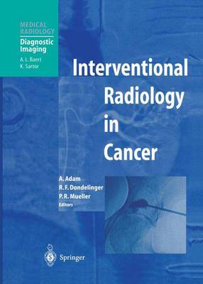 Interventional Radiology in Cancer Softcover reprint of the original 1st ed. 2004