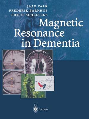 Magnetic Resonance in Dementia Softcover reprint of the original 1st ed. 2002