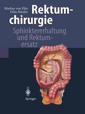 Rektumchirurgie: Sphinktererhaltung und Rektumersatz Softcover Reprint of the Original 1st 1997 ed.