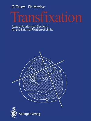 Transfixation: Atlas of Anatomical Sections for the External Fixation of Limbs 1987 ed.