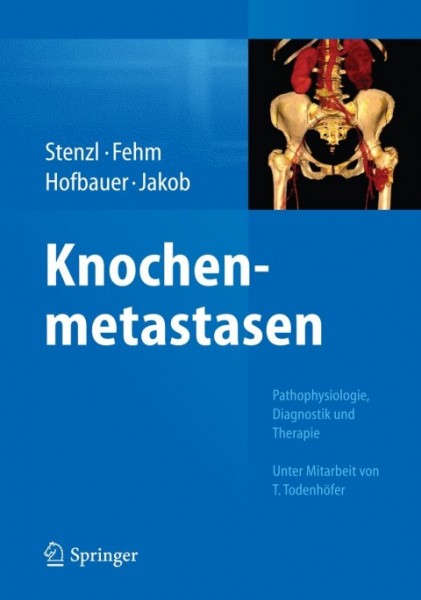 Knochenmetastasen: Pathophysiologie, Diagnostik und Therapie - Unter Mitarbeit von T. Todenhofer