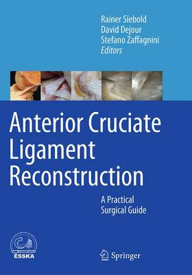 Anterior Cruciate Ligament Reconstruction: A Practical Surgical Guide Softcover reprint of the original 1st ed. 2014
