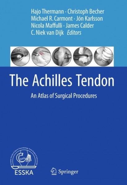 Achilles Tendon: An Atlas of Surgical Procedures