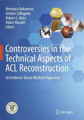 Controversies in the Technical Aspects of ACL Reconstruction: An Evidence-Based Medicine Approach Softcover Reprint of the Original 1st 2017 ed.